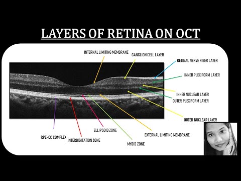 Видео: Узнайте, как определить слои сетчатки с помощью ОКТ | Сетчатка | Офтальмология