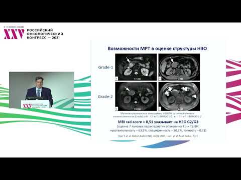 Видео: Современные тренды и проблемы выбора лечебно-диагностической тактики у больных НЭО ЖКТ