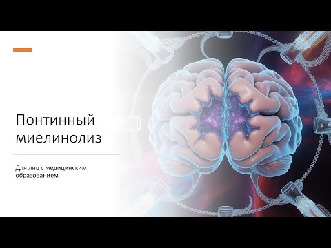Видео: Понтинный миелинолиз