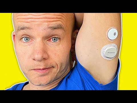 Видео: FreeStyle Libre 3 против Dexcom G7 | Полный тест и обзор