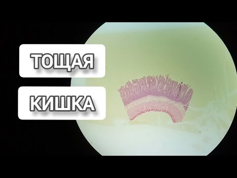 Видео: ТОЩАЯ КИШКА