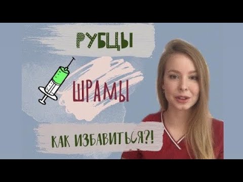Видео: Шрамы (рубцы). Как избавиться ? Мнение хирурга Гудковой С.А.