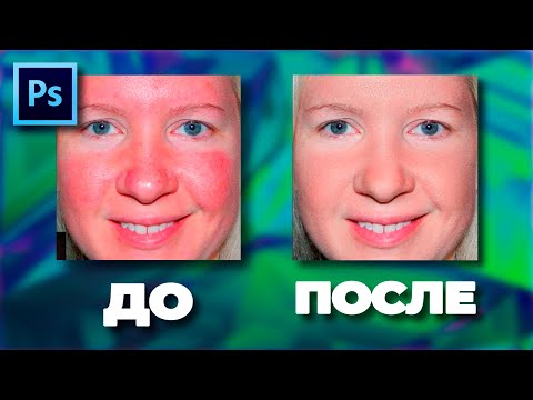 Видео: Как убрать красные пятна на коже в Фотошопе | How to remove red spots on the skin in Photoshop