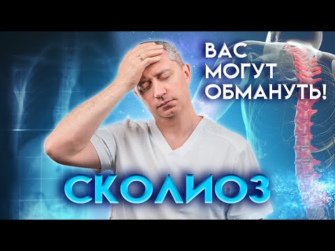 Видео: Как проверить осанку у взрослых и детей? Вся правда про сколиоз!