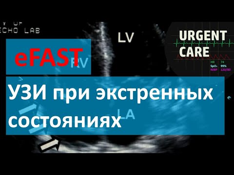 Видео: Протокол ультразвукового исследования eFAST