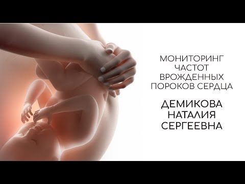 Видео: Мониторинг частот врожденных пороков сердца