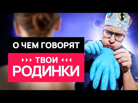 Видео: Какие РОДИНКИ- опасны? 10 вопросов о родинках и загаре #онкология #кожа #родинки