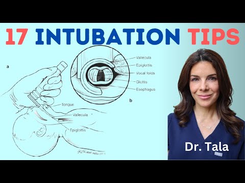 Видео: 16+ приемов для успешной интубации трахеи у новорожденных!!!