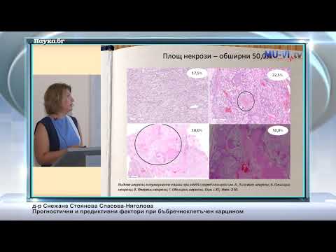 Видео: Прогностични и предиктивни фактори при бъбречноклетъчен карцином