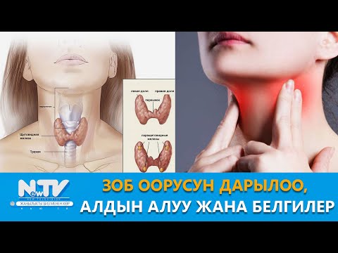 Видео: NewTV// Зоб оорусун дарылоо, алдын алуу жана белгилери. // Дабагер