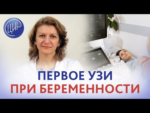 Видео: Первое УЗИ при беременности. Когда делать первое УЗИ и первую допплерометрию при беременности?