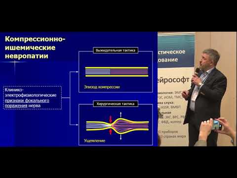 Видео: Э.Ю. Малецкий "Роль УЗ исследования в диагностике поражений периферических нервов"