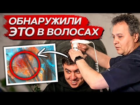 Видео: Как ПРОВОДИТСЯ диагностика волос? / Что такое трихоскопия и для чего она нужна?