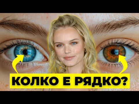 Видео: Различен цвят на очите. Красиво или опасно?