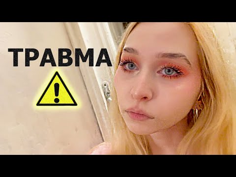 Видео: ИДУ в ТРАВМПУНКТ😱 что можно повредить во время рисования?..