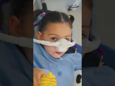 Видео: Закис азоту  та лікування зубів у дитини#закисазоту #дитячийстоматолог #новояворівськ
