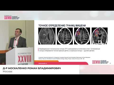 Видео: SBRT: искусство или ремесло?