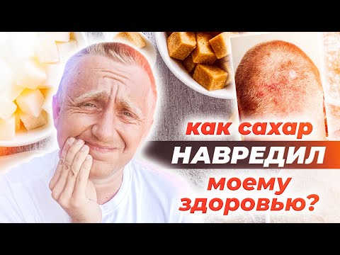 Видео: К чему приводит злоупотребление сладким и как избавиться от зависимости. Мой опыт.