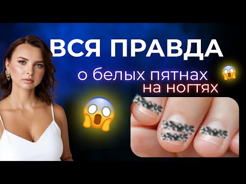 Видео: ЭПИДЕМИЯ БЕЛЫХ ПЯТЕН НА НОГТЯХ! ОТКУДА НА САМОМ ДЕЛЕ ОНИ ПОЯВЛЯЮТСЯ?