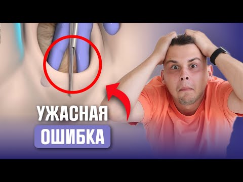 Видео: РАЗРЫВЫ В РОДАХ! Как ПРАВИЛЬНО готовиться к родам, ЧТОБЫ не было разрывов