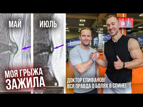 Видео: Правильные тренировки при болях в спине и вся правда о грыжах! Доктор Антон Епифанов