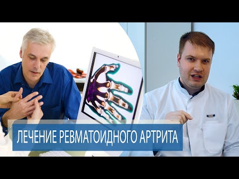 Видео: ЛЕЧЕНИЕ РЕВМАТОИДНОГО АРТРИТА | Способы лечения