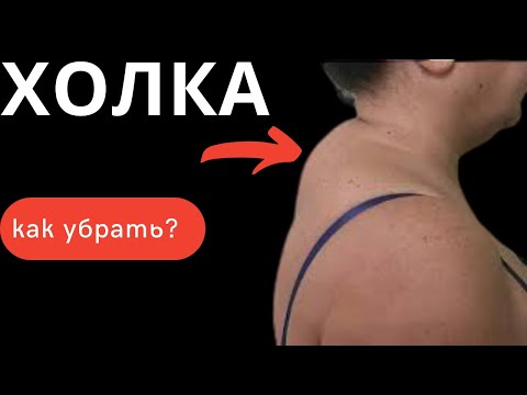 Видео: КАК УБРАТЬ ХОЛКУ НА ШЕЕ