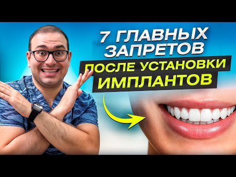 Видео: Что НЕЛЬЗЯ делать после имплантации зубов? 7 Главных Запретов, Которые Спасут Вашу Улыбку!!