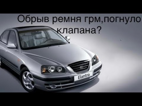 Видео: Хёндай Элантра 2005 года 1,6 16 клапанник ремонт гбц после обрыва ремня грм.