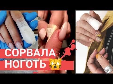 Видео: СРОЧНО спасаю ноготь 😰 СОРВАННЫЙ ноготь — что делать? Модный маникюр 2020. Этнический дизайн ногтей