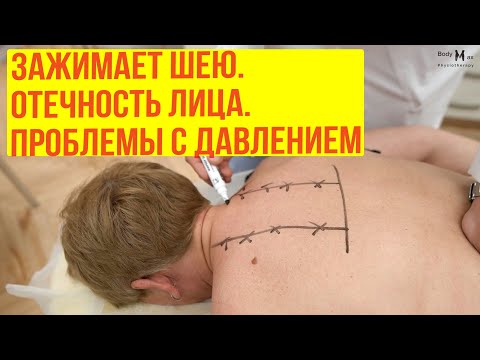 Видео: Зажимает шею. Отечность лица. Проблемы с давлением