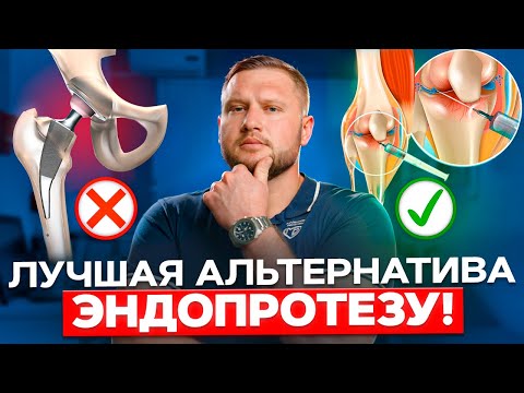 Видео: Это новый метод лечения суставов БЕЗ ЗАМЕНЫ НА ПРОТЕЗ! Как избежать эндопротезирования в 2025?