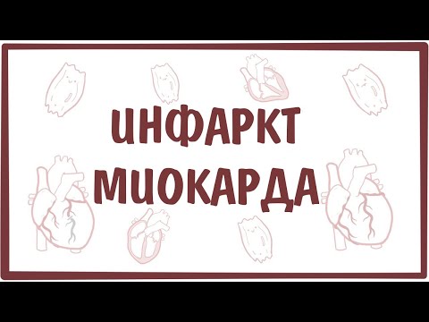 Видео: Инфаркт Миокарда