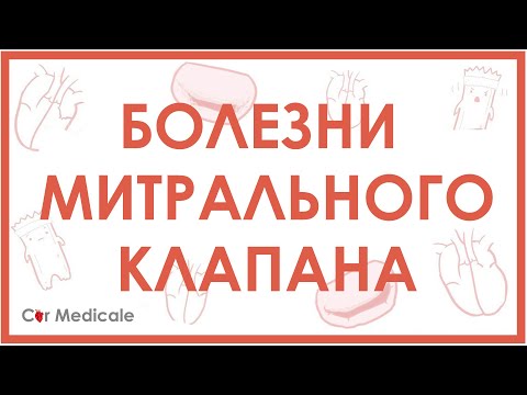 Видео: Болезни митрального клапана. Пролапс митрального клапана, стеноз, регургитация.