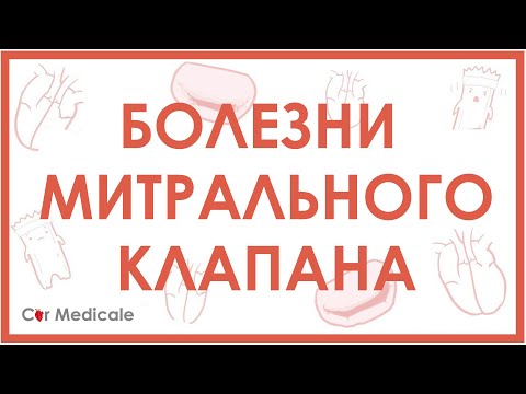 Видео: Болезни митрального клапана. Пролапс митрального клапана, стеноз, регургитация.