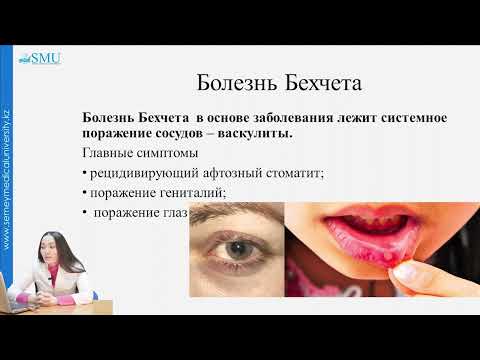Видео: Хронический рецидивирующий афтозный стоматит