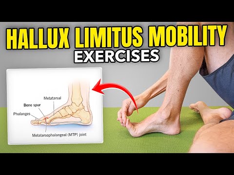 Видео: Упражнения на подвижность большого пальца ноги (Hallux Limitus)