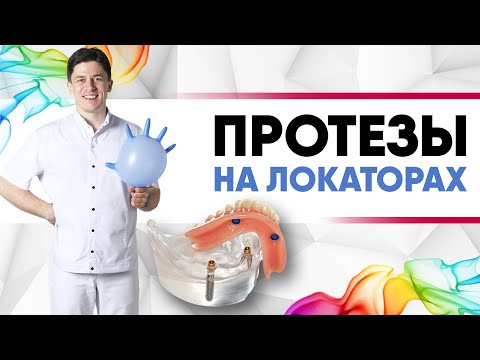 Видео: Съёмный протез на локаторах на имплантах [ локатор - замок, удерживающий съёмные зубные протезы ]