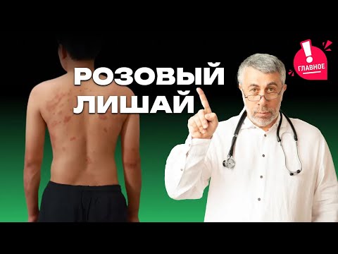 Видео: Розовый лишай Жибера или просто - розовый лишай