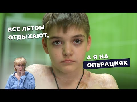 Видео: ХИРУРГИЯ НЕВУСОВ: ОСЛОЖНЕНИЯ | История Дениса Кеняйкина