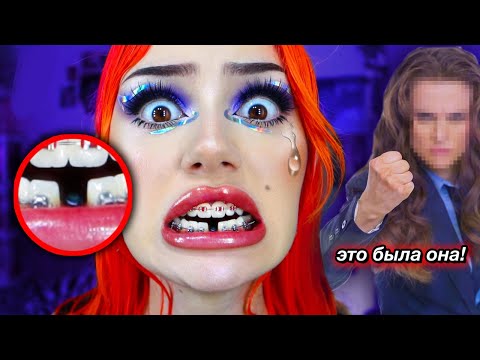 Видео: МНЕ ВЫБИЛА ЗУБ ХОЗЯЙКА КВАРТИРЫ!😢