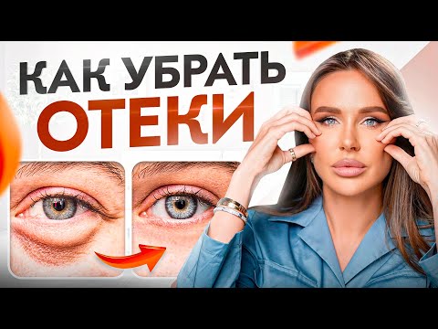 Видео: ОТЕКИ всегда имеют причину! Как избавиться от отеков?