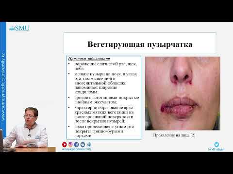 Видео: Пузырчатка