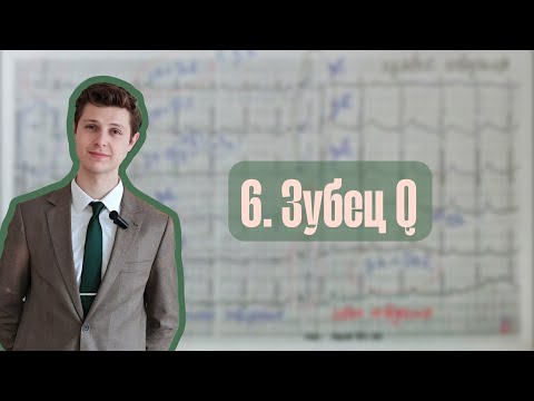 Видео: Алгоритм анализа ЭКГ | 6. Зубец Q