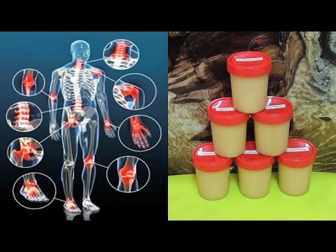 Видео: Мазь "Грибной 🍄 жир". Боль 💥 в суставах и позвоночнике.