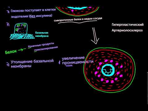 Видео: Артериолосклероз, часть 2