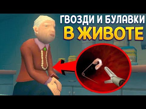 Видео: БУЛАВКИ И ГВОЗДИ ВНУТРИ ЖИВОТА