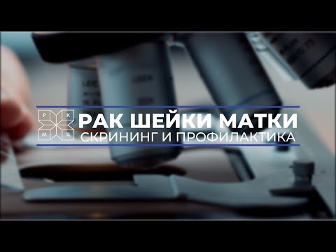 Видео: Рак шейки матки: диагностика