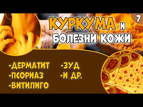 Видео: КУРКУМА (видео 7): болезни кожи. Псориаз. Дерматит. Витилиго.