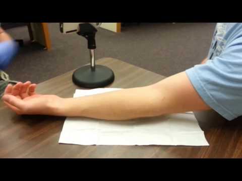 Видео: Как начать внутривенное вливание: локтевая ямка